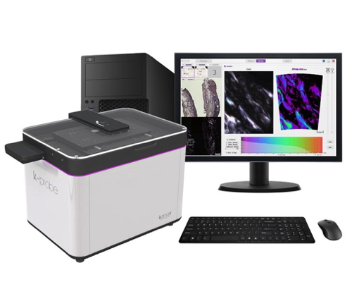 Using the K-PROBE device, a next generation automated microscope, the...