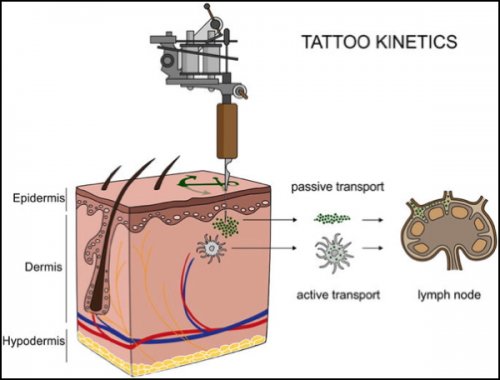Translocation of tattoo particles from skin to lymph nodes. - Source :...