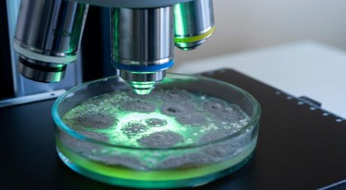Microbiome, fermentation : En 2022, un nouveau regard sur les bactéries !